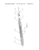 Luminal Structure Anchoring Devices and Methods diagram and image