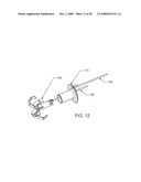 Luminal Structure Anchoring Devices and Methods diagram and image