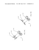 Luminal Structure Anchoring Devices and Methods diagram and image