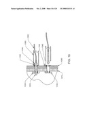 Luminal Structure Anchoring Devices and Methods diagram and image