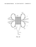 Luminal Structure Anchoring Devices and Methods diagram and image