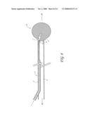 METHODS AND APPARATUS FOR THROMBECTOMY SYSTEM diagram and image