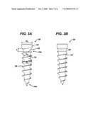 Passive Screw Locking Mechanism diagram and image