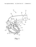 BIASED ACOUSTIC SWITCH FOR IMPLANTABLE MEDICAL DEVICE diagram and image