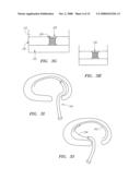DEVICES USED TO TREAT DISC HERNIATION AND ATTACHMENT MECHANISMS THEREFORE diagram and image