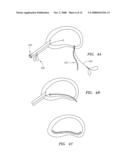 DEVICES USED TO TREAT DISC HERNIATION AND ATTACHMENT MECHANISMS THEREFORE diagram and image