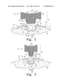 MOBILE BEARING ASSEMBLY diagram and image