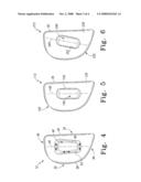 MOBILE BEARING ASSEMBLY diagram and image