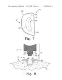 MOBILE BEARING ASSEMBLY diagram and image