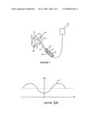 ATTITUDE DETECTION SYSTEM AND METHOD diagram and image