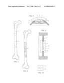 Method for the Production of a Biologically Active Prosthetic Device for the Reconstruction of Bone Tissue and the Prosthetic Device Itself diagram and image