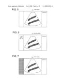 MEDICAL IMAGE FILE OUTPUT APPARATUS, MEDICAL IMAGE DIAGNOSTIC APPARATUS AND METHOD FOR OUTPUTTING MEDICAL IMAGE FILE diagram and image