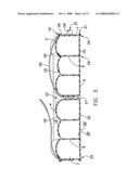 Inflatable Mattress and Method for Positioning a Patient diagram and image