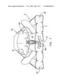 Inflatable Mattress and Method for Positioning a Patient diagram and image