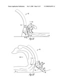 SNOW BLADE ATTACHMENT diagram and image