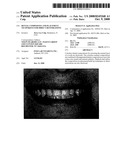 DENTAL COMPOSITES AND PLACEMENT TECHNIQUES FOR DIRECT RESTORATIONS diagram and image