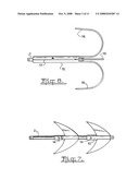 Modular Boat Anchoring System diagram and image