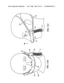 Patient Interface Device diagram and image