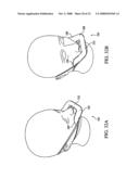 Patient Interface Device diagram and image