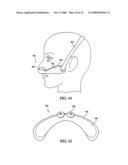 Patient Interface Device diagram and image