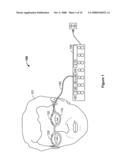 Method and Apparatus for Correcting Vision Using an Electro-Active Phoropter diagram and image