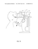 ORTHOVOLTAGE RADIOSURGERY diagram and image