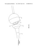 ORTHOVOLTAGE RADIOSURGERY diagram and image