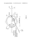 ORTHOVOLTAGE RADIOSURGERY diagram and image