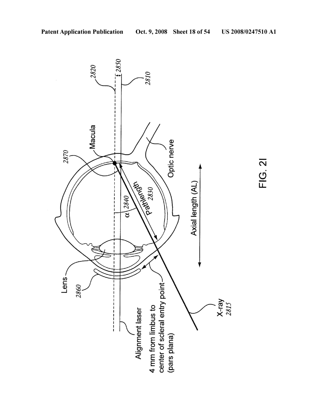 ORTHOVOLTAGE RADIOSURGERY - diagram, schematic, and image 19