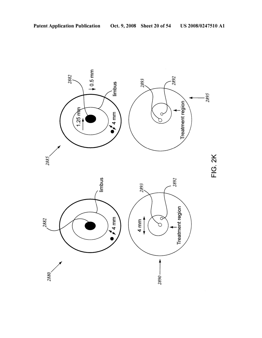 ORTHOVOLTAGE RADIOSURGERY - diagram, schematic, and image 21