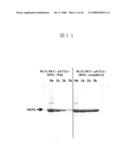 Genetic polymorphisms associated with myocardial infarction, methods of detection and uses thereof diagram and image