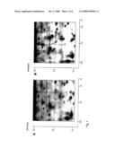 METHOD FOR DIAGNOSIS OF ALZHEIMER S DISEASE WITH DETERMINATION OF LASP-1 IMMUNOREACTIVITY diagram and image