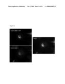 NOVEL GENES RELATED TO GLUTAMINYL CYCLASE diagram and image