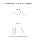 BLOOD PRESSURE MONITORING APPARATUS AND METHOD diagram and image