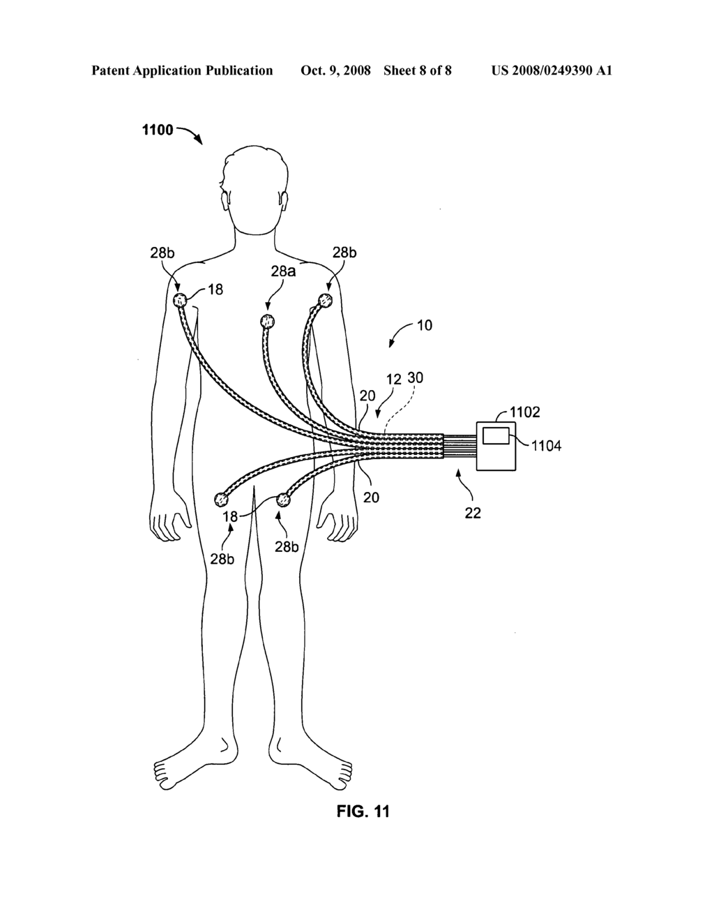 Electrode lead set for measuring physiologic information - diagram, schematic, and image 09