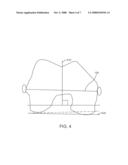 METHOD FOR IMPROVED ROTATIONAL ALIGNMENT IN JOINT ARTHROPLASTY diagram and image