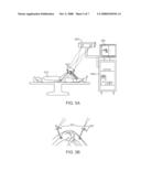 METHOD FOR IMPROVED ROTATIONAL ALIGNMENT IN JOINT ARTHROPLASTY diagram and image