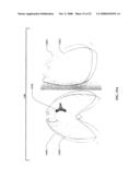 METHOD AND APPARATUS FOR CONTROLLING CATHETER POSITIONING AND ORIENTATION diagram and image