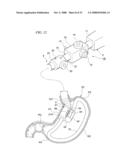 GASTRIC THERAPY SYSTEM AND METHOD FOR SUTURING GASTRIC WALL diagram and image