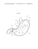 GASTRIC THERAPY SYSTEM AND METHOD FOR SUTURING GASTRIC WALL diagram and image