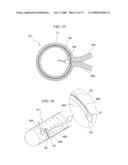 GASTRIC THERAPY SYSTEM AND METHOD FOR SUTURING GASTRIC WALL diagram and image