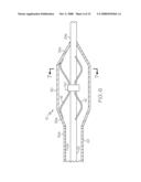 Catheter Having Internal Mechanisms to Encourage Balloon Re-folding diagram and image