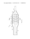 Catheter Having Internal Mechanisms to Encourage Balloon Re-folding diagram and image