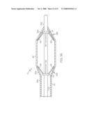 Catheter Having Internal Mechanisms to Encourage Balloon Re-folding diagram and image