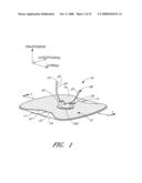 Anchoring System For a Catheter diagram and image