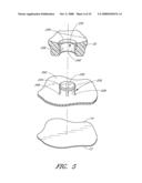 Anchoring System For a Catheter diagram and image