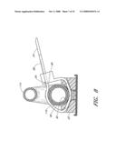 Anchoring System For a Catheter diagram and image