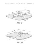 Anchoring System For a Catheter diagram and image