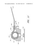 Anchoring System For a Catheter diagram and image