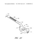 Anchoring System For a Catheter diagram and image